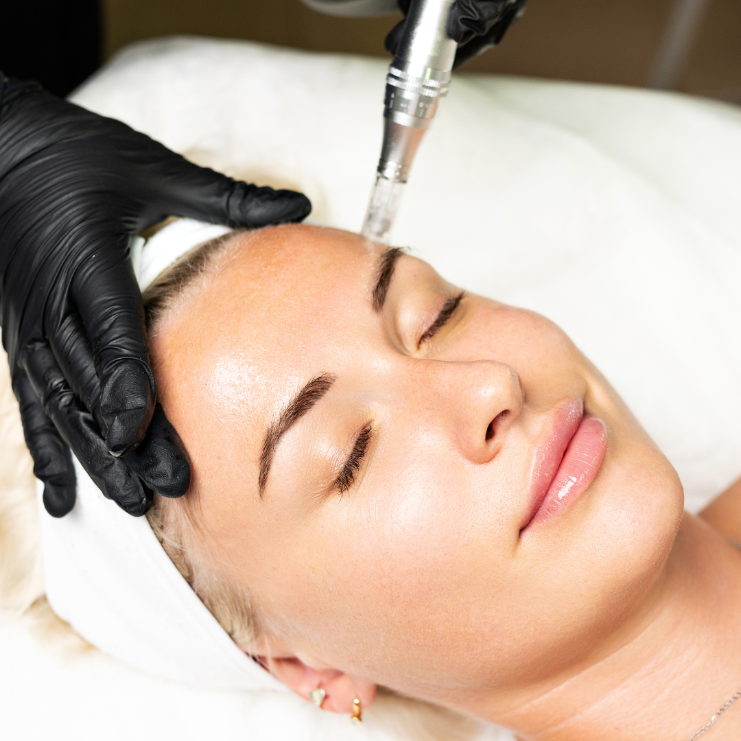 Online Microneedling