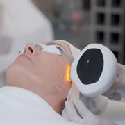 Online IPL Skin Rejuvenation