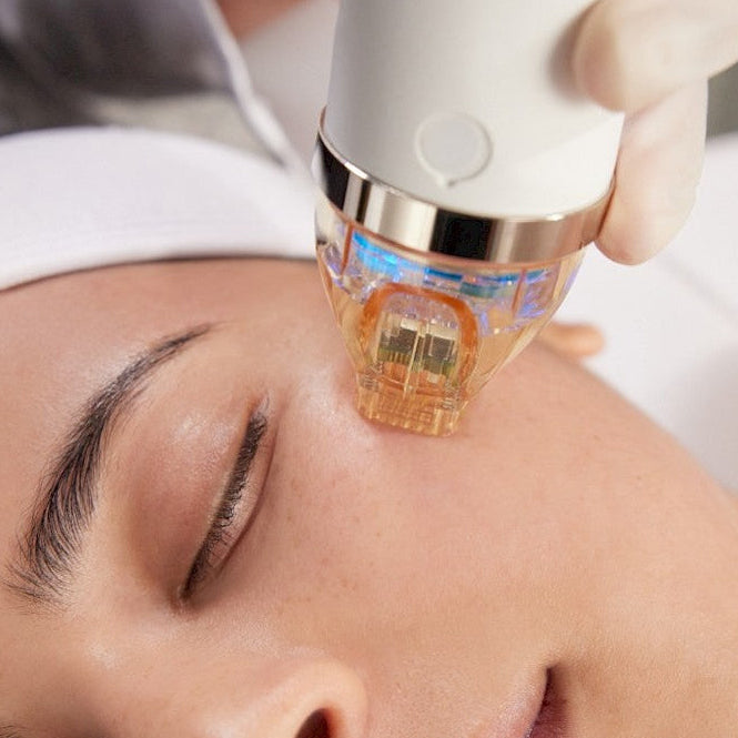 Online Radiofrequency Microneedling
